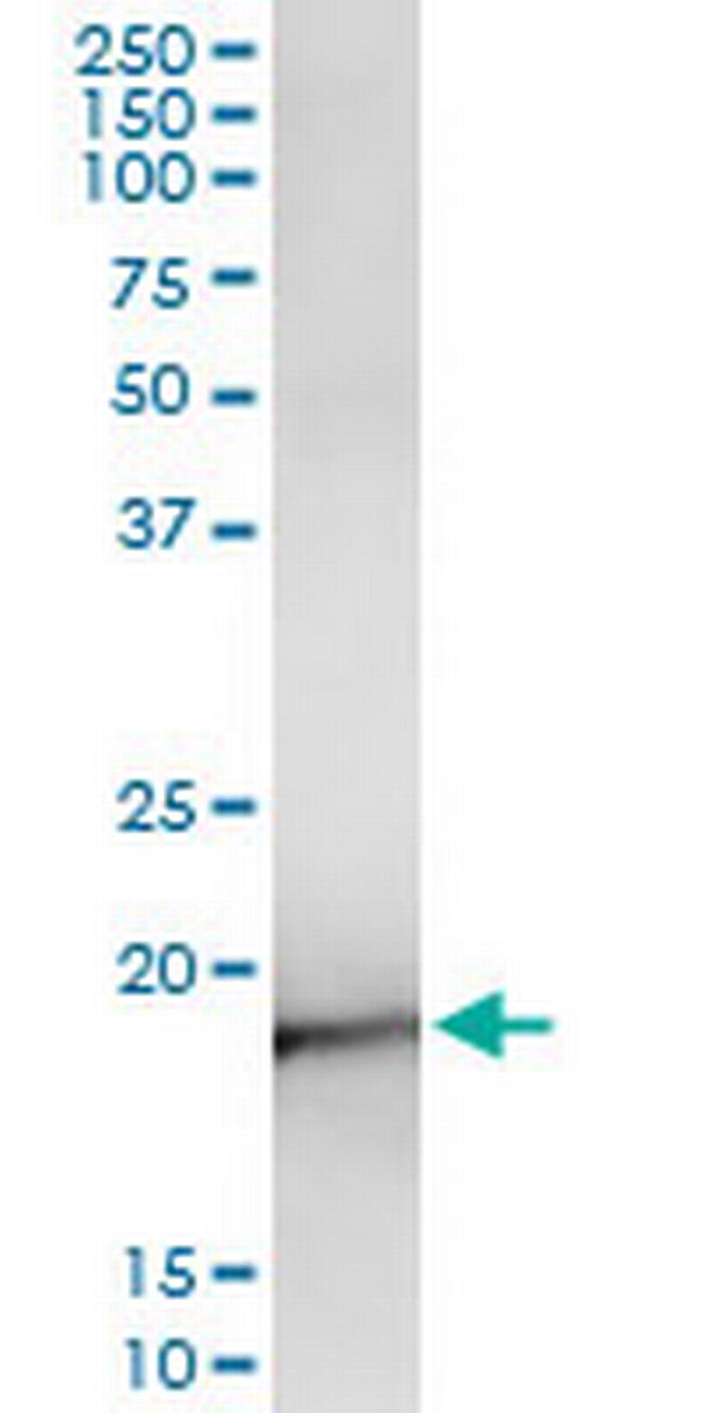 NEUROG3 Antibody in Immunoprecipitation (IP)