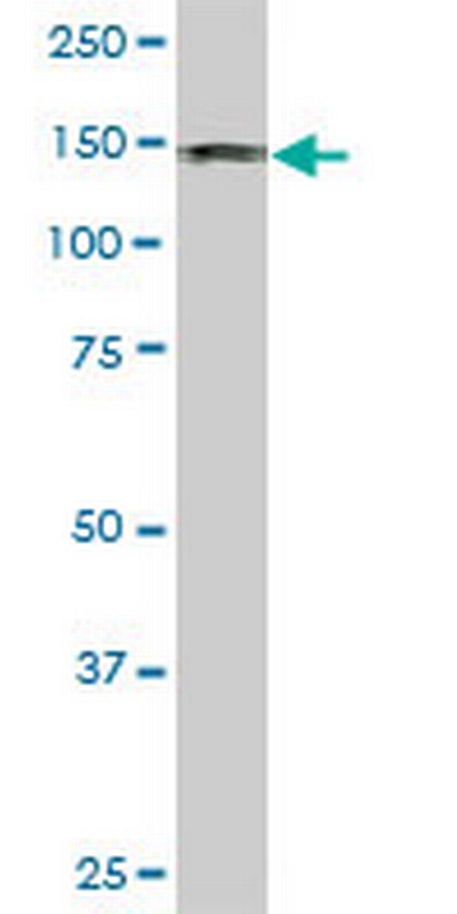 DDEF1 Antibody in Western Blot (WB)