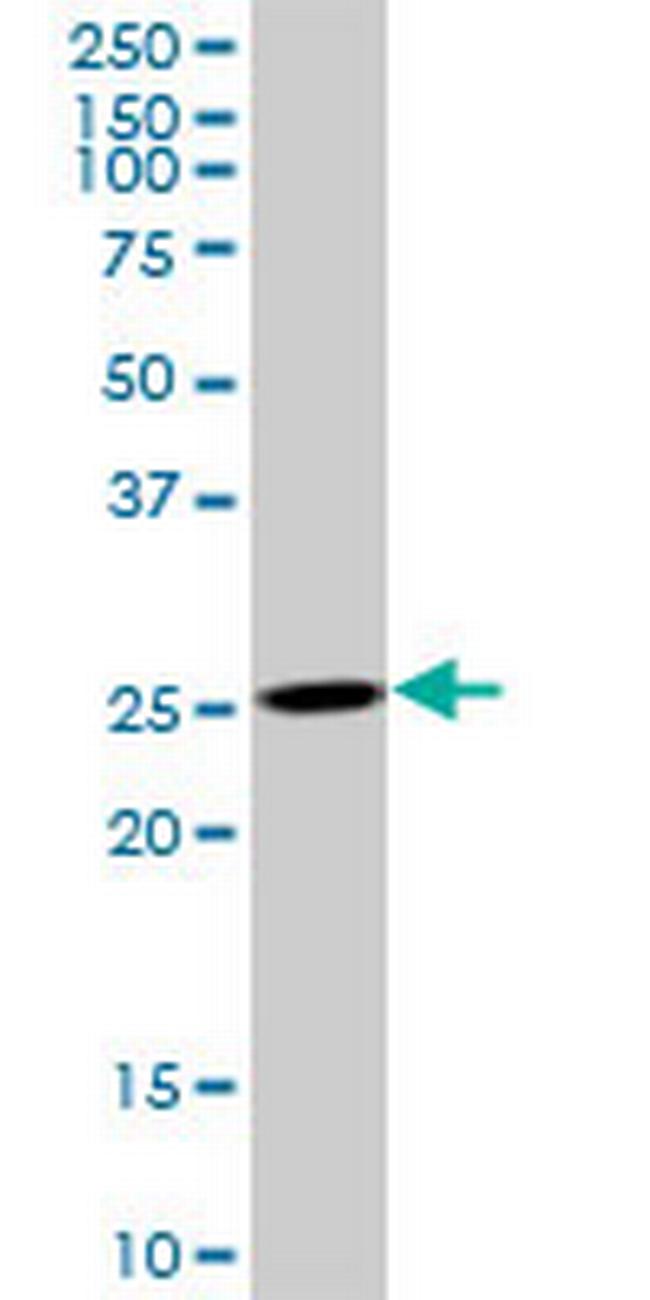 AK3 Antibody in Western Blot (WB)