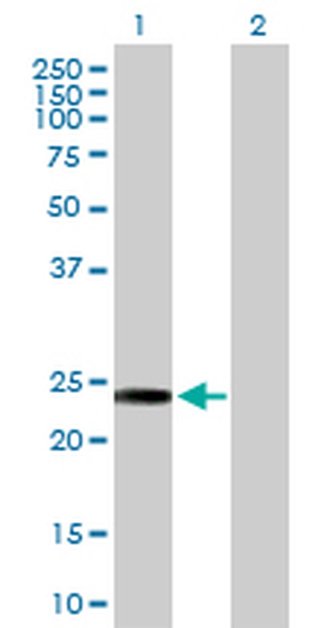 AK3 Antibody in Western Blot (WB)