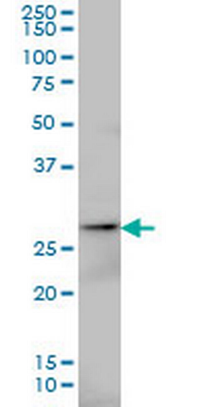 AK3 Antibody in Western Blot (WB)