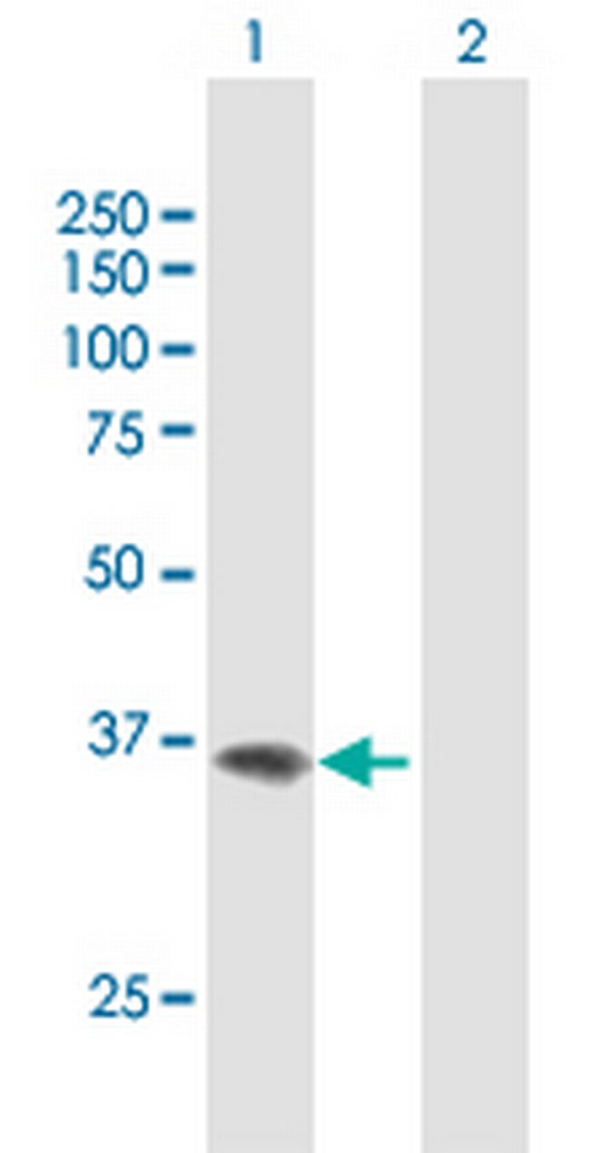 F11R Antibody in Western Blot (WB)