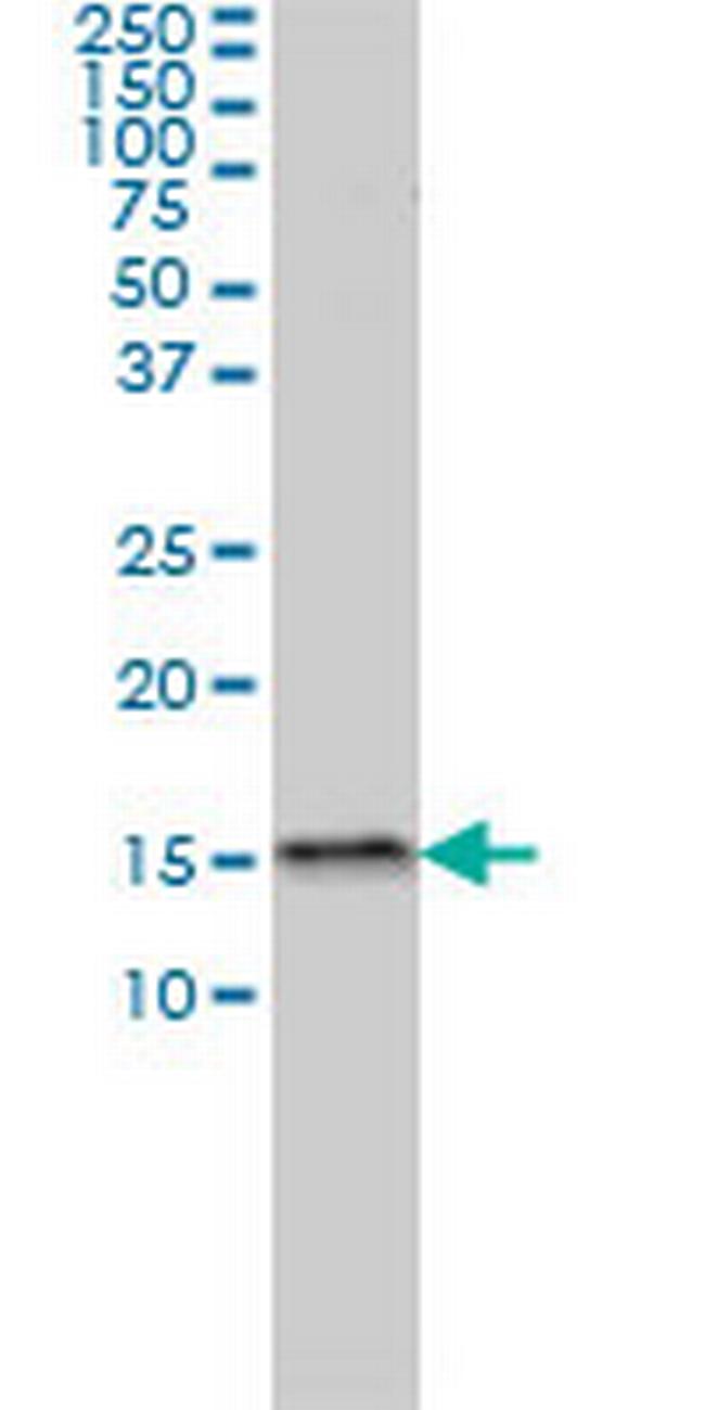 MED31 Antibody in Western Blot (WB)