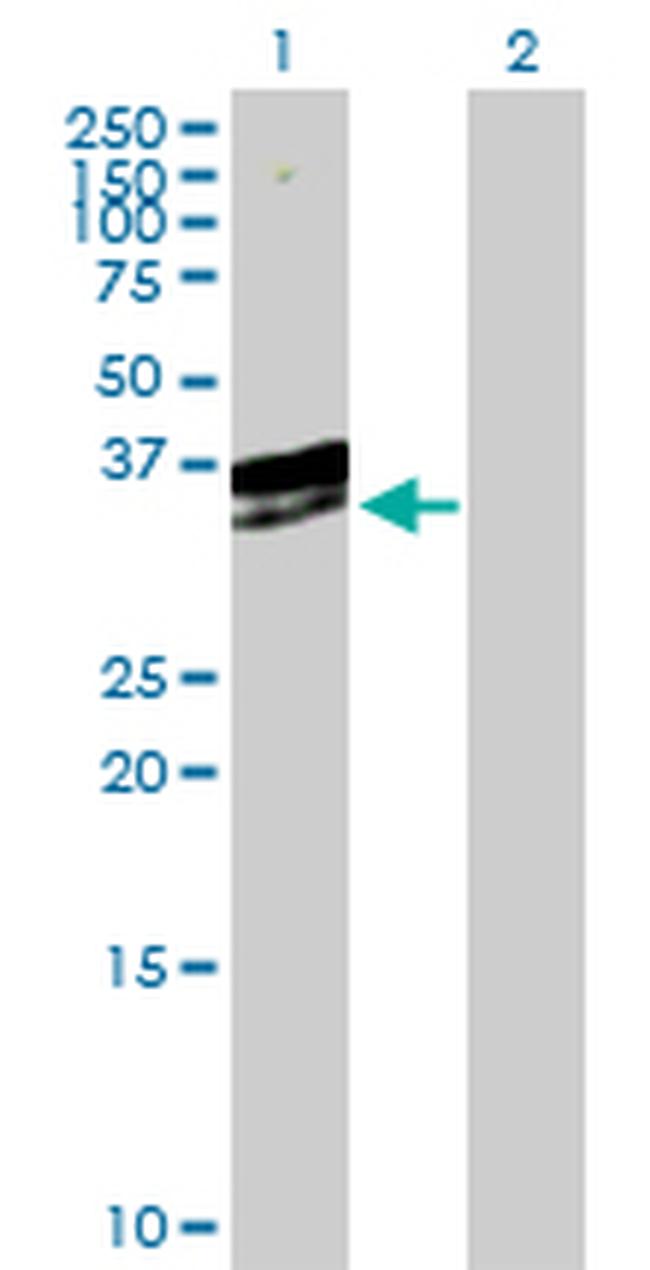 EXOSC3 Antibody in Western Blot (WB)