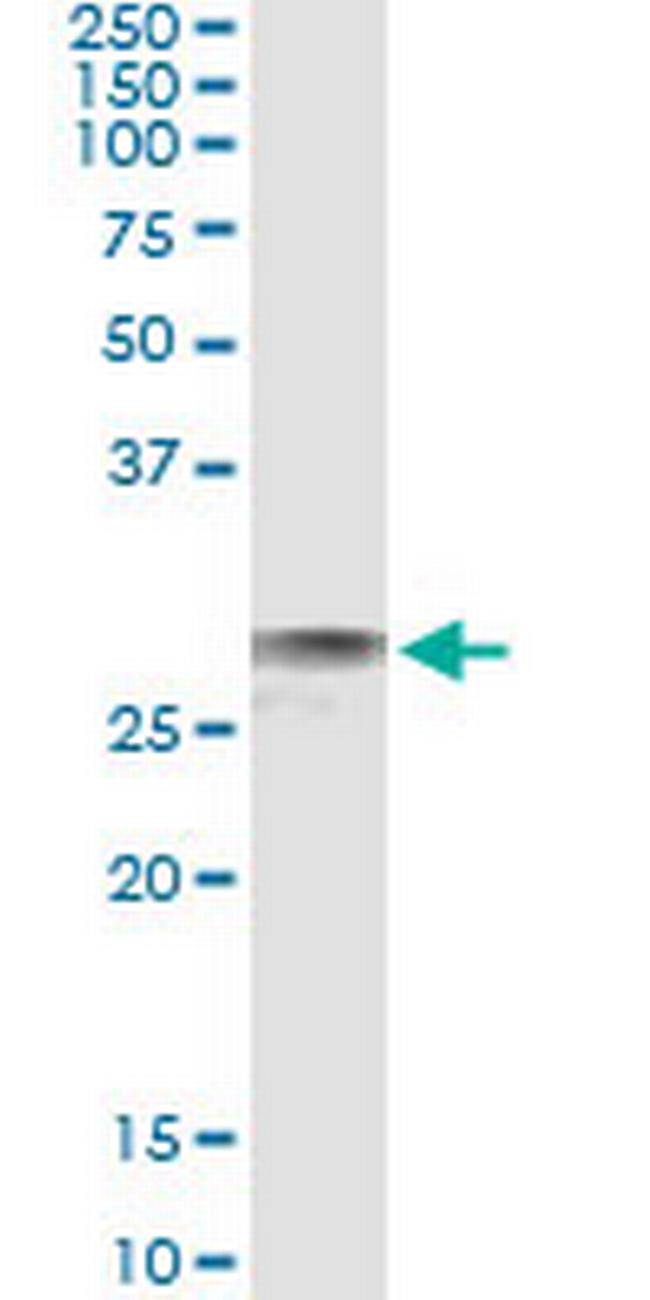 EXOSC3 Antibody in Immunoprecipitation (IP)