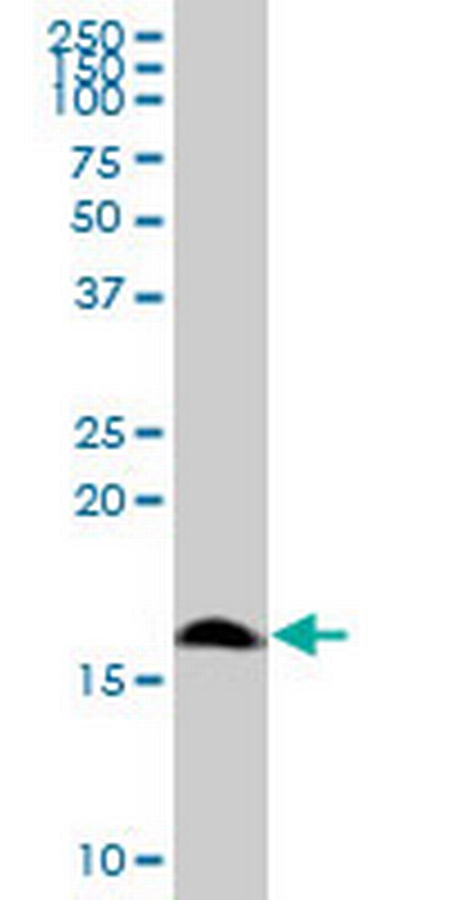 POLR1D Antibody in Western Blot (WB)