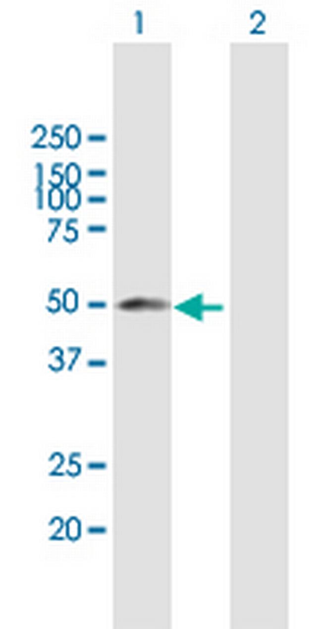 YBX2 Antibody in Western Blot (WB)