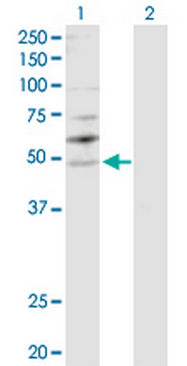 YBX2 Antibody in Western Blot (WB)