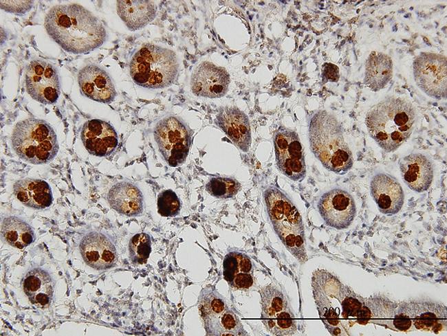 ABHD5 Antibody in Immunohistochemistry (Paraffin) (IHC (P))