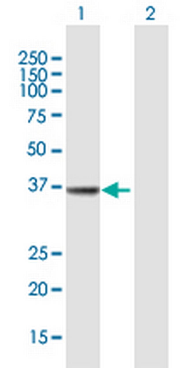 MECR Antibody in Western Blot (WB)