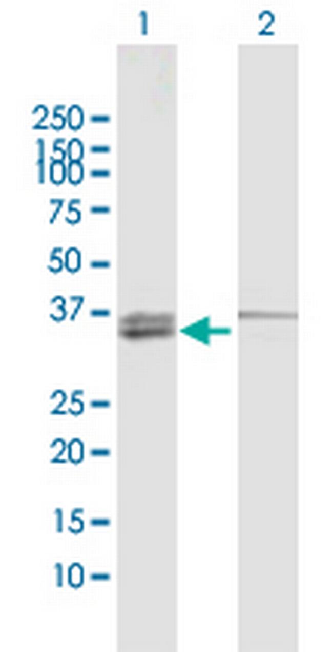 MECR Antibody in Western Blot (WB)