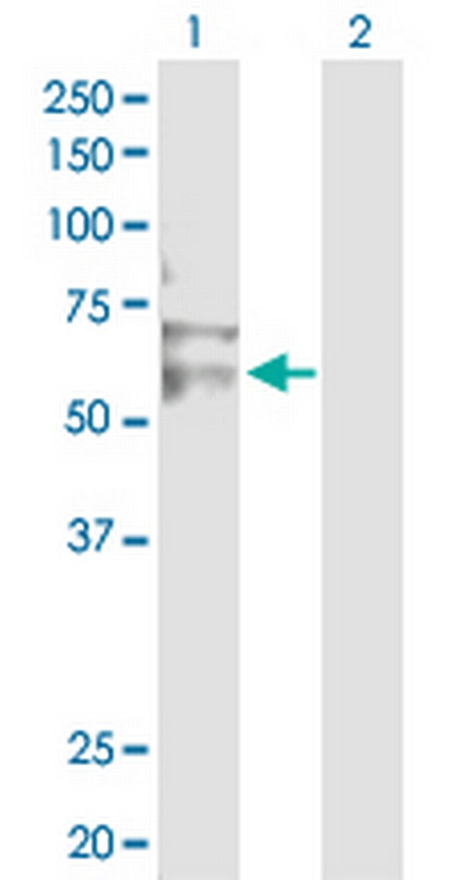 RNF12 Antibody in Western Blot (WB)