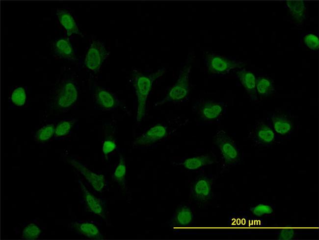 LEF1 Antibody in Immunocytochemistry (ICC/IF)