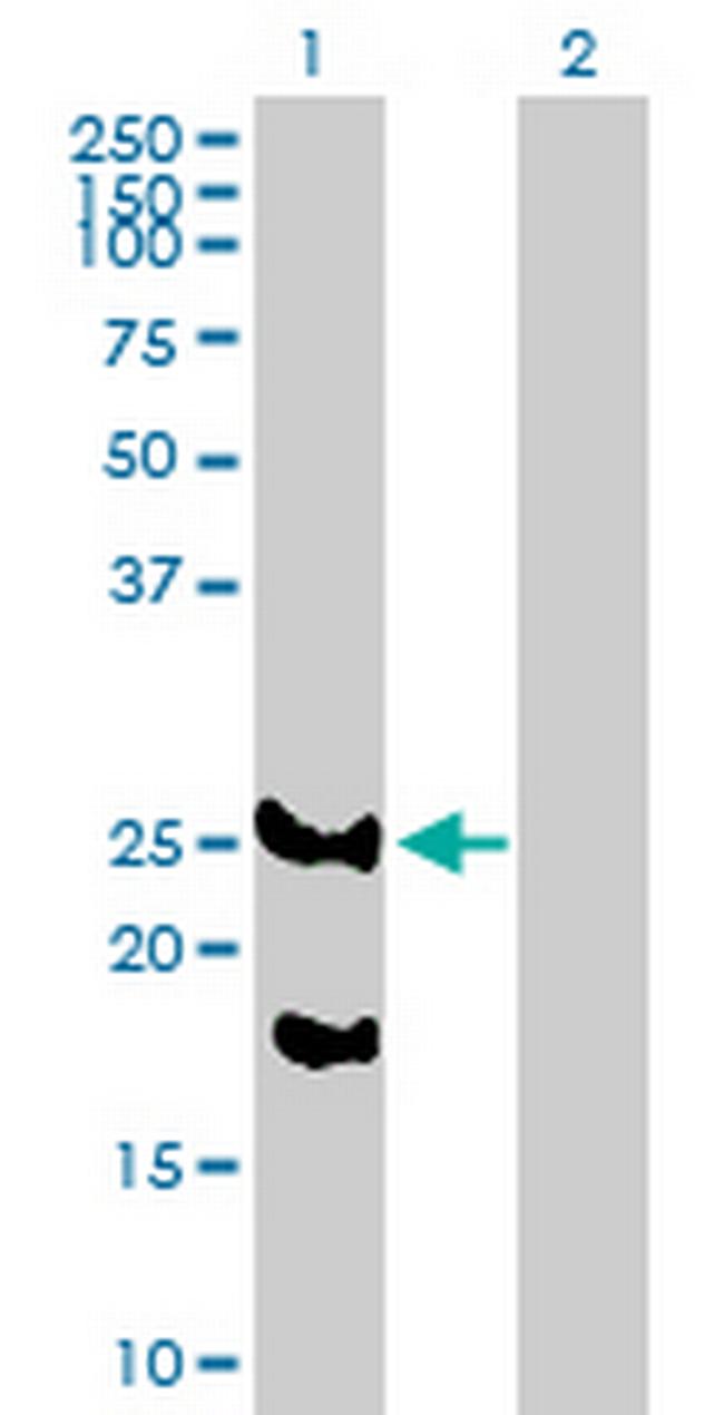 C5orf19 Antibody in Western Blot (WB)