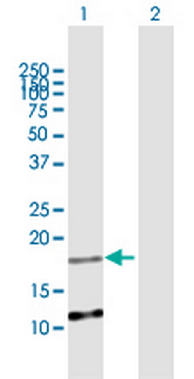 C2orf28 Antibody in Western Blot (WB)