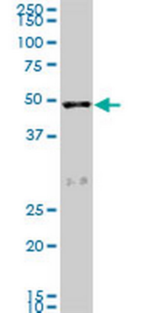 SCARA3 Antibody in Western Blot (WB)