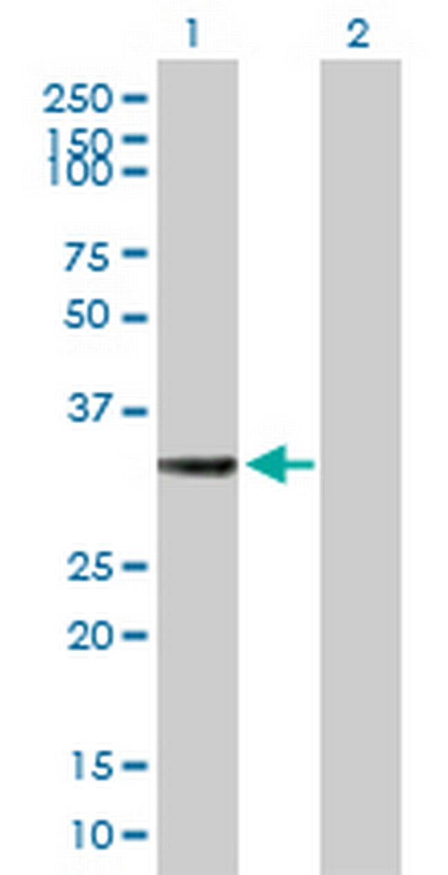 HSD17B7 Antibody in Western Blot (WB)