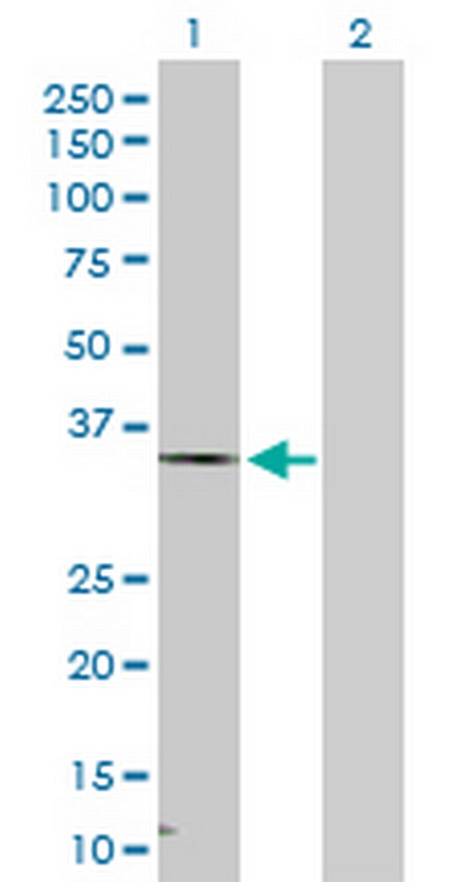 HSD17B7 Antibody in Western Blot (WB)