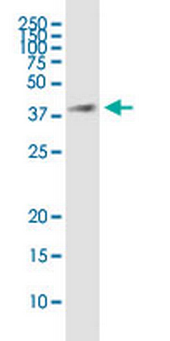 HSD17B7 Antibody in Western Blot (WB)