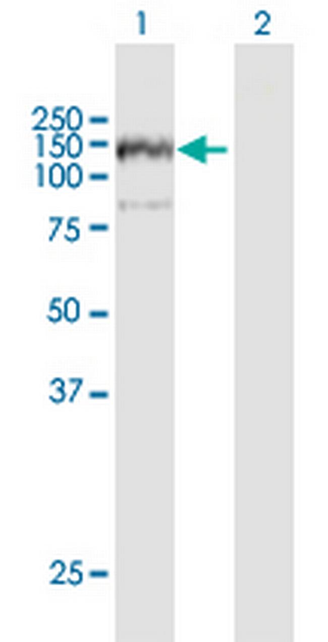 ANKFY1 Antibody in Western Blot (WB)