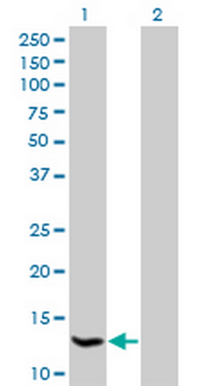 HSPC152 Antibody in Western Blot (WB)