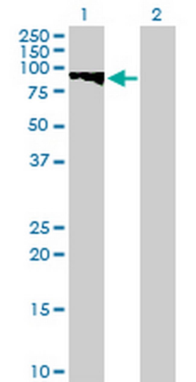 GTSE1 Antibody in Western Blot (WB)