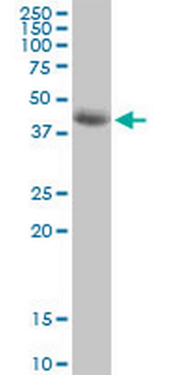 SIRT7 Antibody in Western Blot (WB)