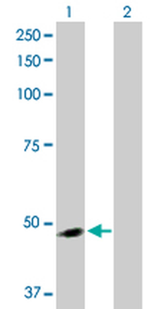 ARMCX3 Antibody in Western Blot (WB)