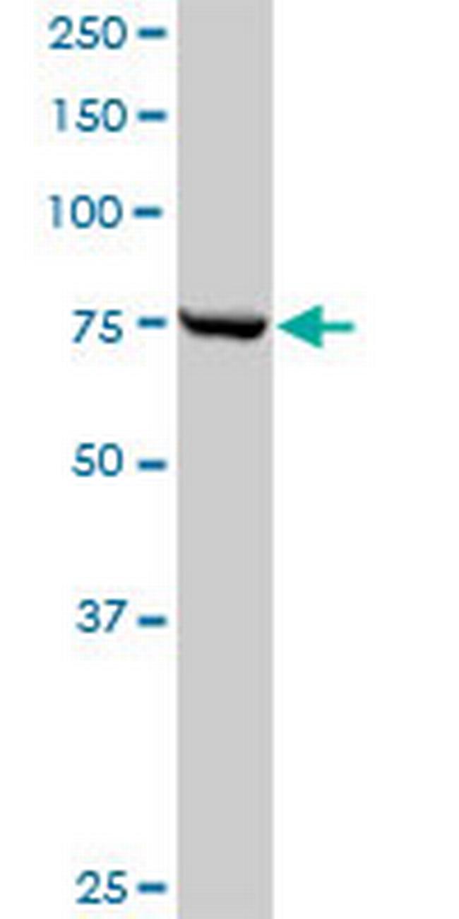 CPSF3 Antibody in Western Blot (WB)