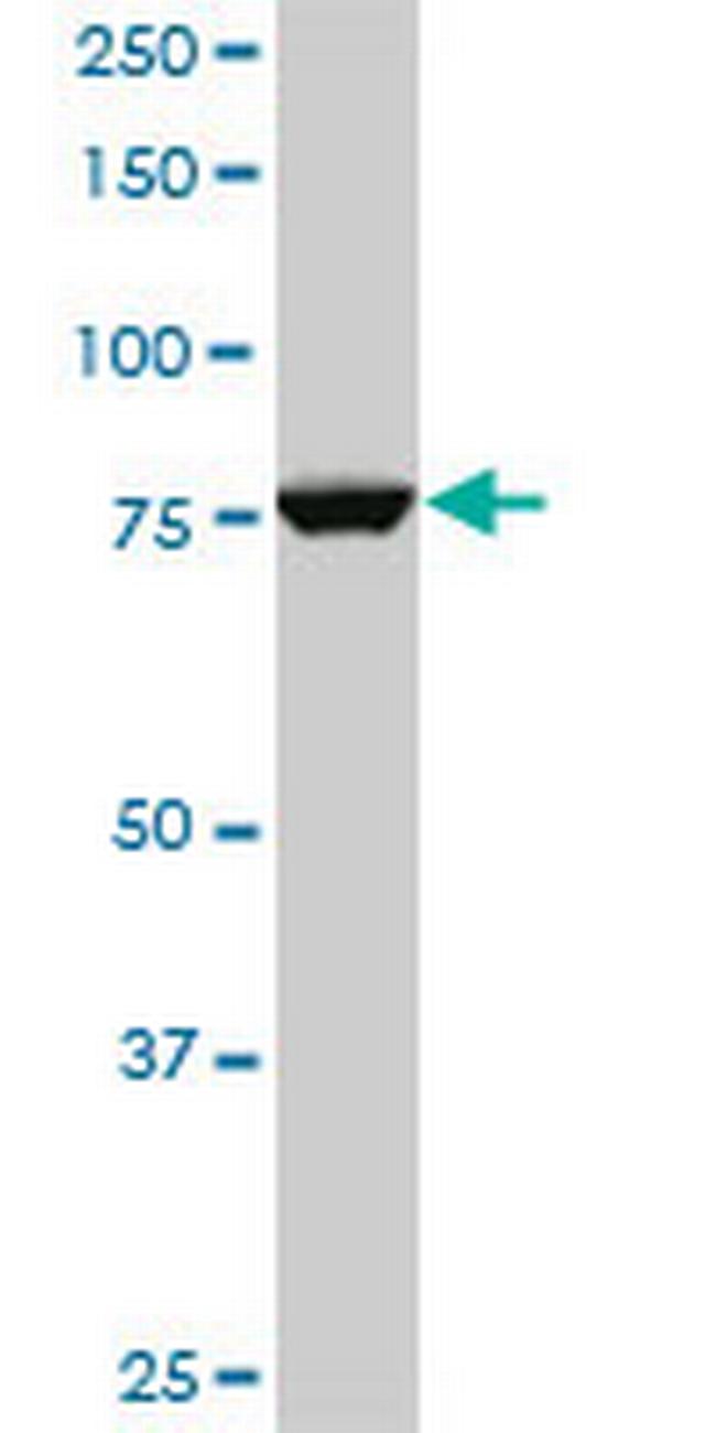 CPSF3 Antibody in Western Blot (WB)