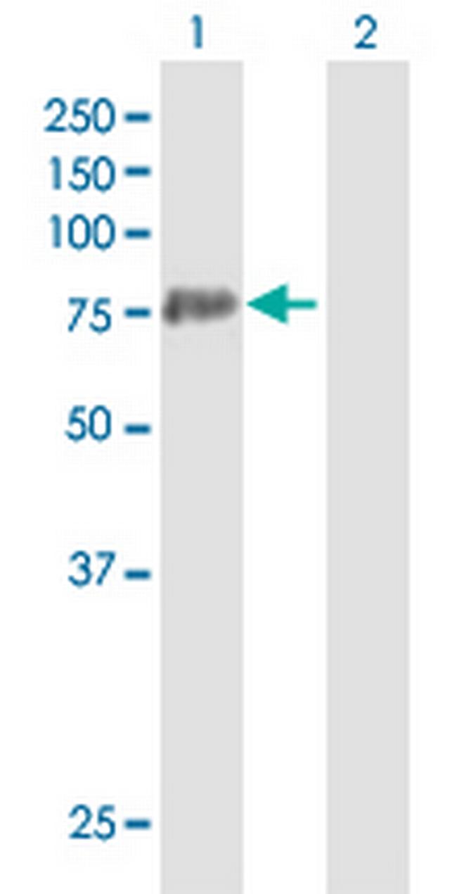 PADI3 Antibody in Western Blot (WB)