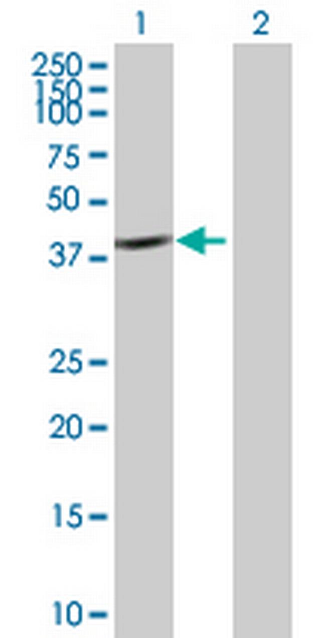 CAB39 Antibody in Western Blot (WB)