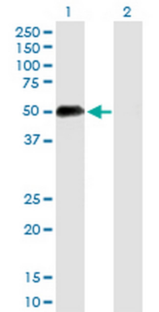 UIMC1 Antibody in Western Blot (WB)