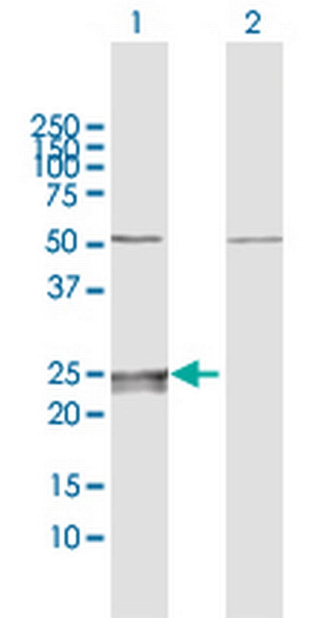 CMPK1 Antibody in Western Blot (WB)