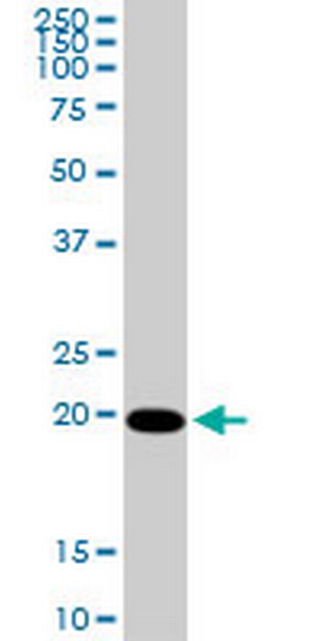 CMPK Antibody in Western Blot (WB)