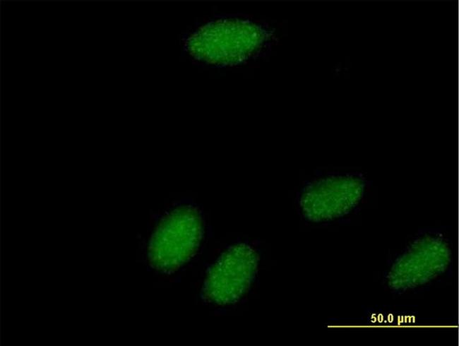 POLR3K Antibody in Immunocytochemistry (ICC/IF)