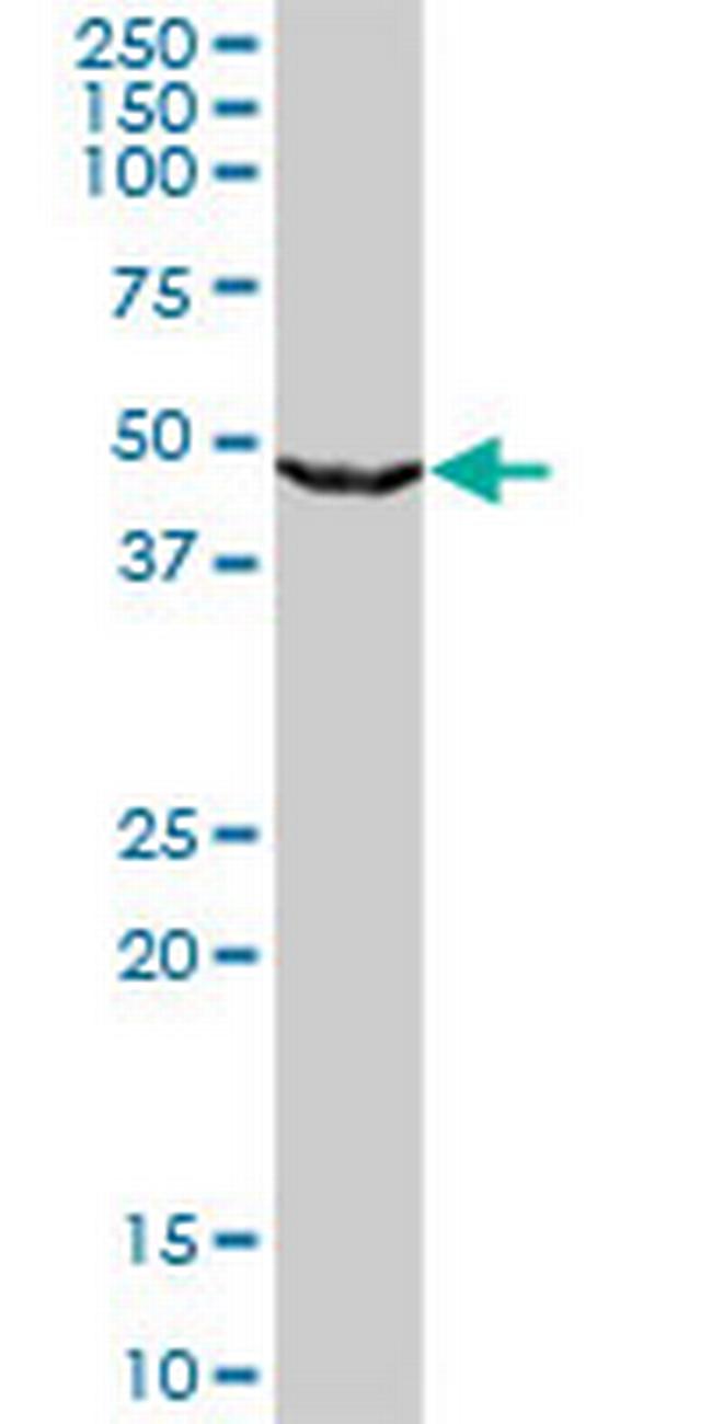 UPB1 Antibody in Western Blot (WB)