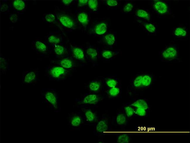 SIX4 Antibody in Immunocytochemistry (ICC/IF)