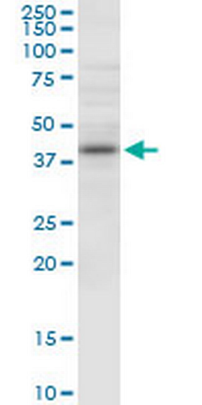 NUDT9 Antibody in Western Blot (WB)