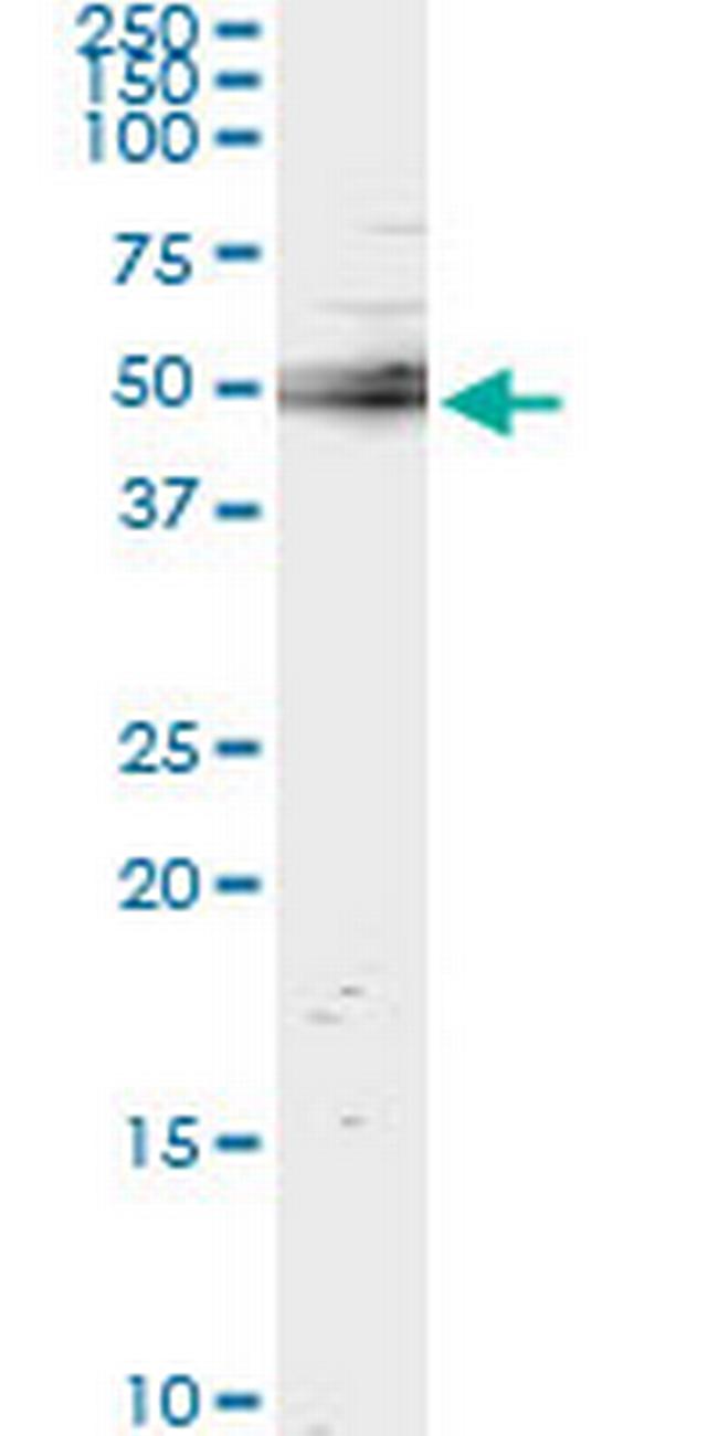 UBASH3A Antibody in Immunoprecipitation (IP)