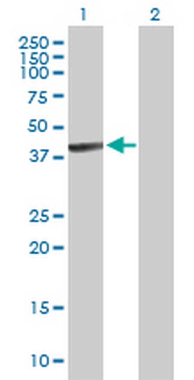 PANK1 Antibody in Western Blot (WB)