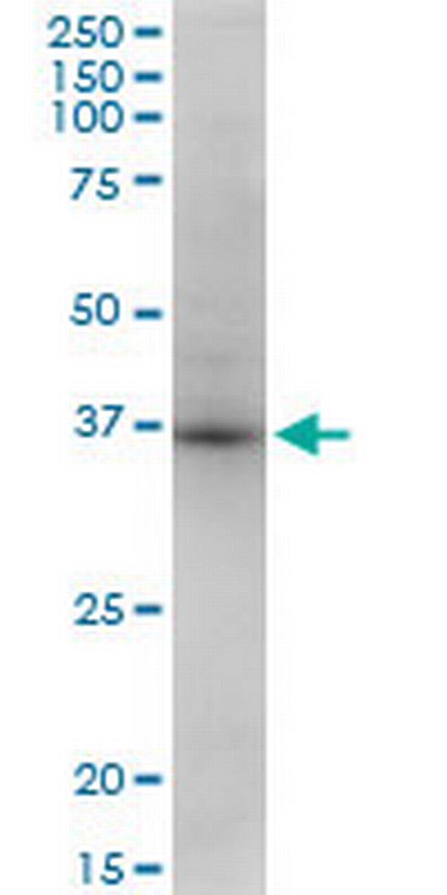 STX18 Antibody in Western Blot (WB)