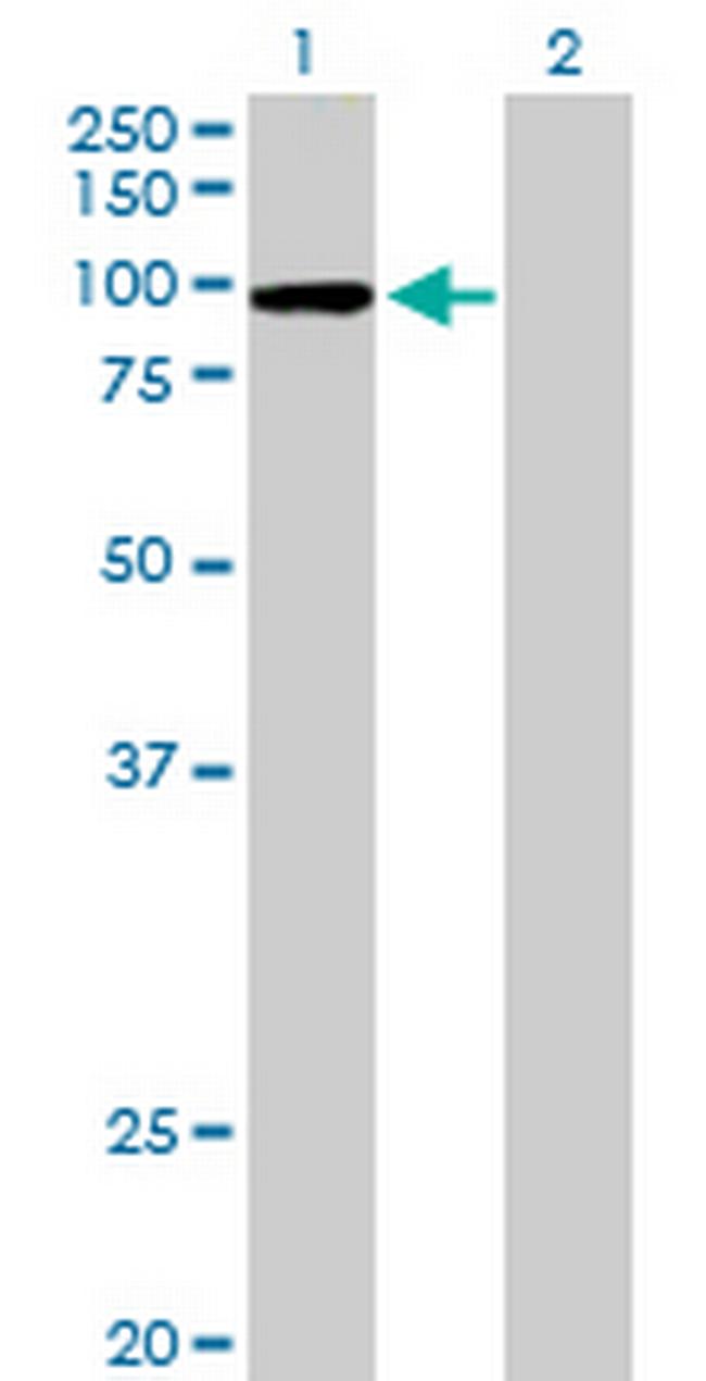 CPSF2 Antibody in Western Blot (WB)