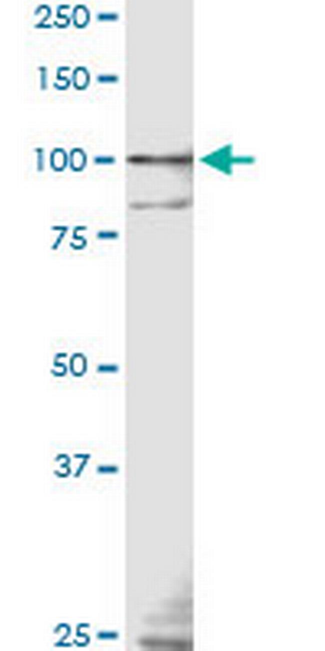 TLR9 Antibody in Western Blot (WB)