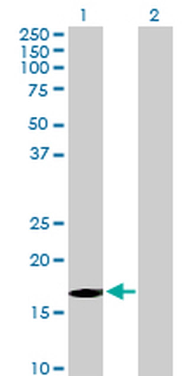 FBXW5 Antibody in Western Blot (WB)