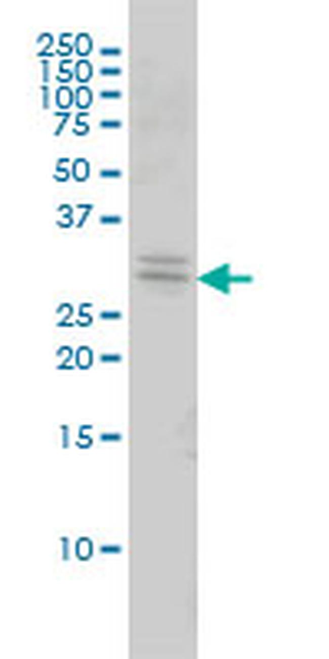 TOLLIP Antibody in Western Blot (WB)