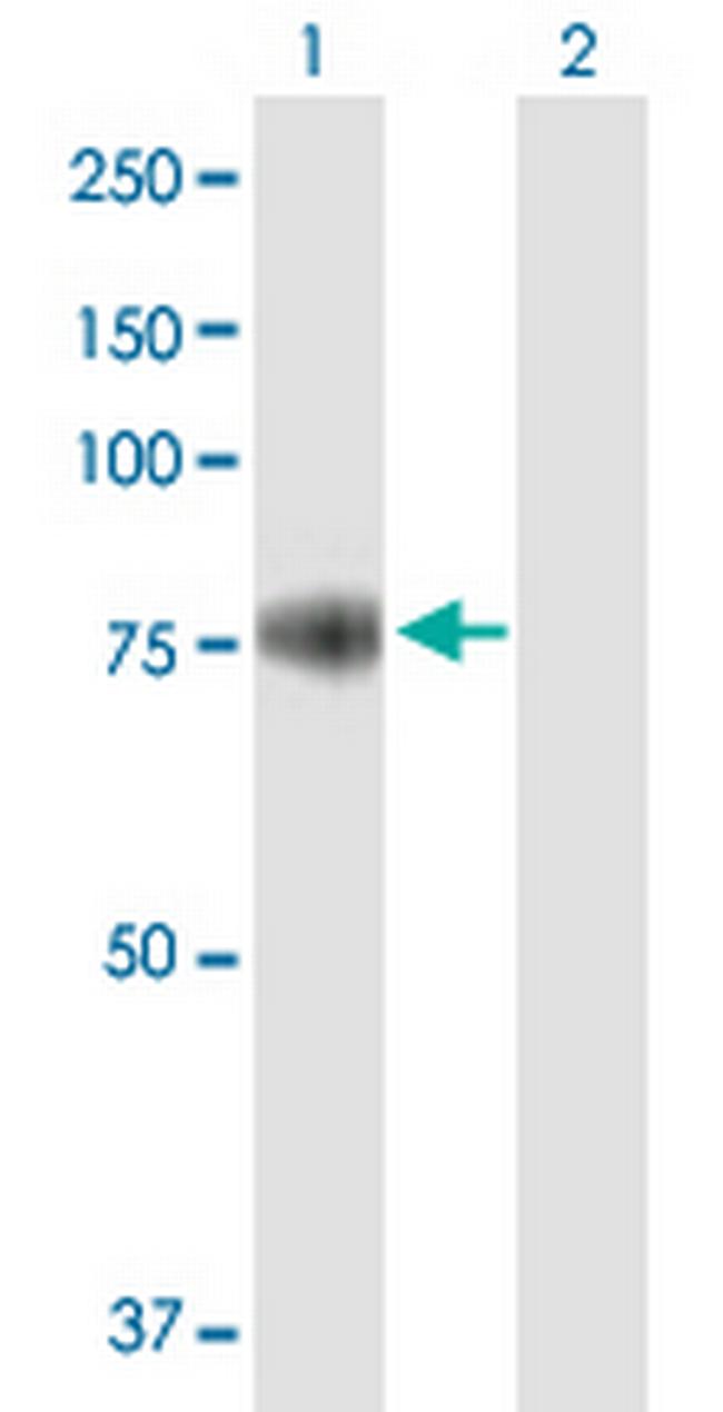 PRMT7 Antibody in Western Blot (WB)