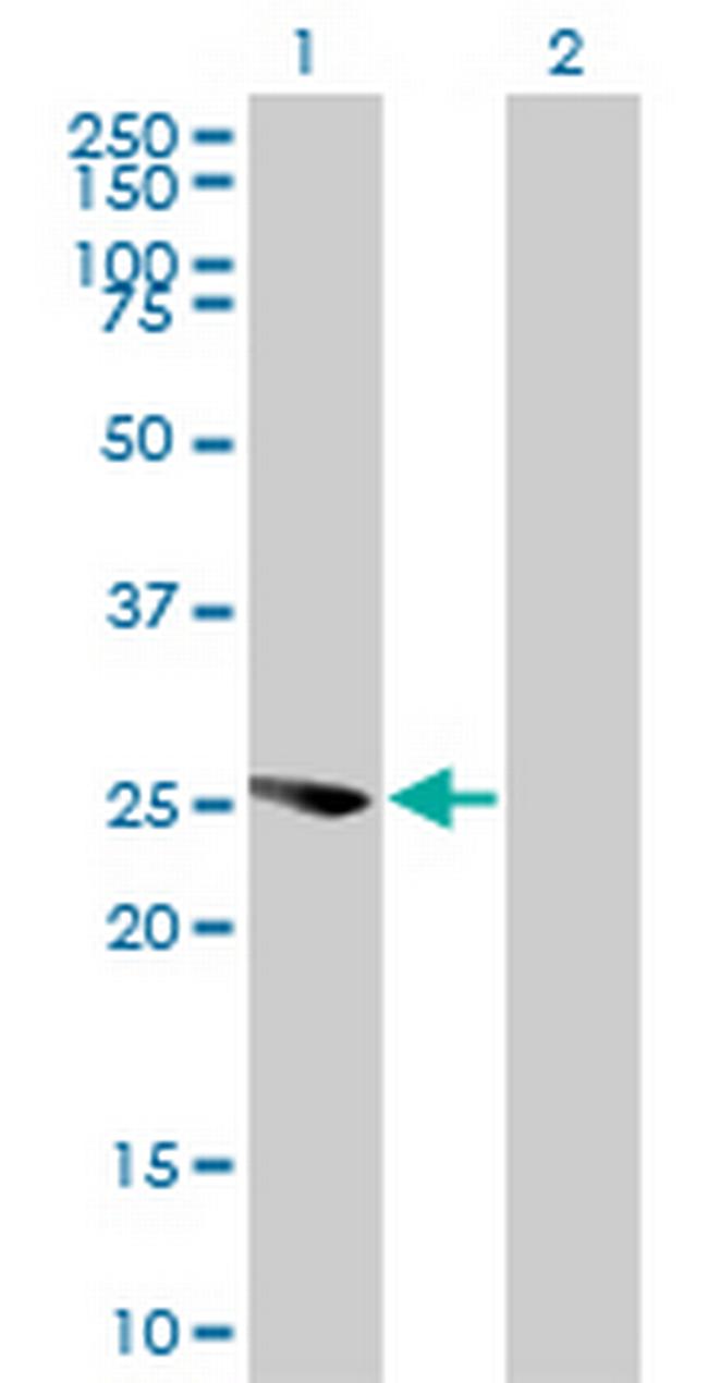 EXOSC4 Antibody in Western Blot (WB)