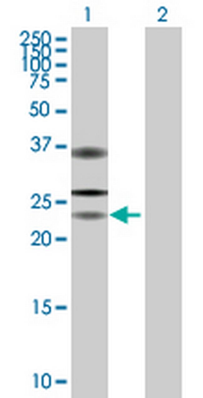 USP53 Antibody in Western Blot (WB)