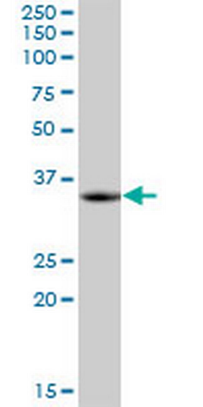 LZTFL1 Antibody in Western Blot (WB)